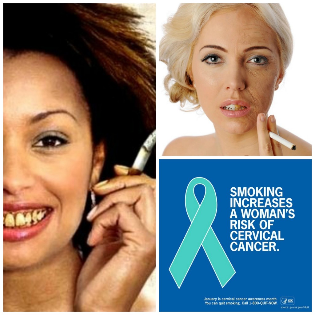 Smoking causes ages skin with wrinkles, yellowing of teeth and fingers.