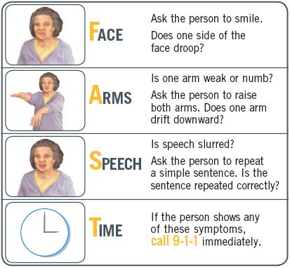 Warning signs and symptoms of a stroke