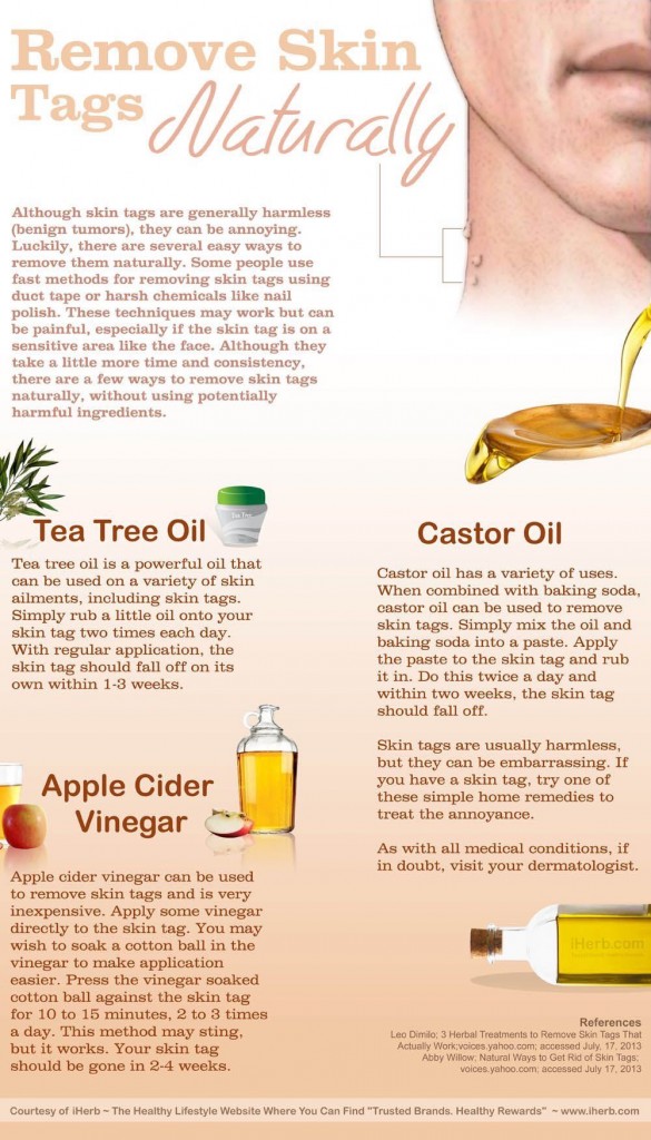 Natural remedies to remove skin lesions. Image credit: iHerb.com